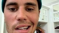 Kondisi Wajah Justin Bieber yang Idap Ramsay Hunt Syndrome