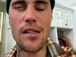 Ramsay Hunt Syndrome Justin Bieber Kambuh, Terpaksa Tunda Tur Lagi