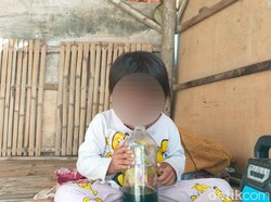 Balita di Sampang Kecanduan Hirup Aroma Bensin Sejak Usia 3 Tahun
