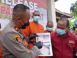 Cekcok Urusan Bisnis, Wiraswasta di Denpasar Tampar-Cekik Kekasih