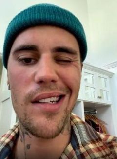 Tangkapan layar instagram Justin Bieber ramsay hunt syndrome/Instagram/justinbieber