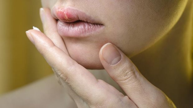 Ilustrasi alergi di bibir