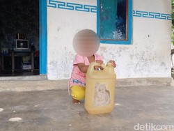 Efek Jangka Panjang Kesehatan Balita Sampang Kecanduan Aroma Bensin