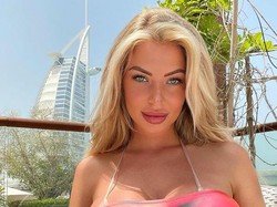 Model Ini Lakukan 3 Kali Operasi Payudara, Dicela Ortu Mirip Karikatur