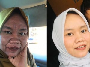 Viral Transformasi Wanita Wajahnya Berubah karena Hamil, Shock Jadi Begini