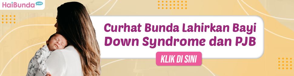 Banner Lahirkan Bayi Down Syndrome