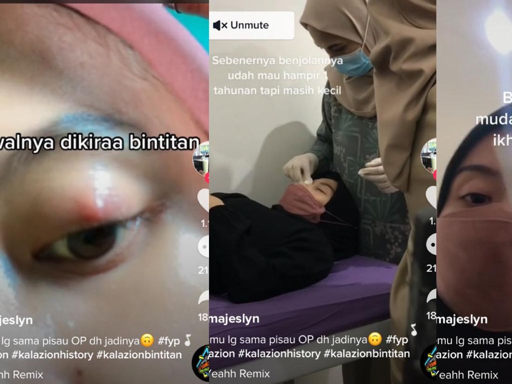 Viral Kisah Gadis Depok Dikira Alami Bintitan Berujung Dioperasi Viral Kisah Gadis Depok Dikira Alami Bintitan Berujung Dioperasi