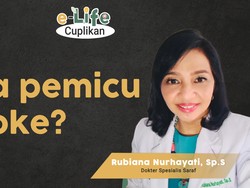 Kena Stroke Usia Muda karena Begadang? Dokter Jantung Ungkap Faktanya