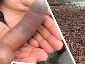 Aneh tapi Nyata: Ribuan Cacing Penis Berserakan Gegerkan Warga AS