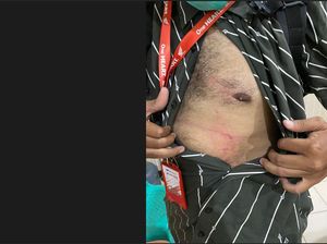 Tabrak Lari di Denpasar, Pengendara Mobil Dipolisikan Pemotor