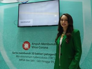 Reisa Broto Asmoro Renovasi Rumah Usai COVID-19 Reda Reisa Broto Asmoro Renovasi Rumah Usai COVID-19 Reda