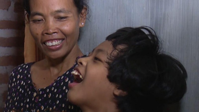 Mari Bantu Syifa, Anak Penjual Gerabah Idap Gangguan Saraf Otak