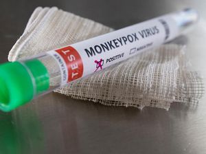 IDI Laporkan Ada 23 Suspek Pasien Cacar Monyet di RI, Seperti Apa Kondisinya? IDI Laporkan Ada 23 Suspek Pasien Cacar Monyet di RI, Seperti Apa Kondisinya?
