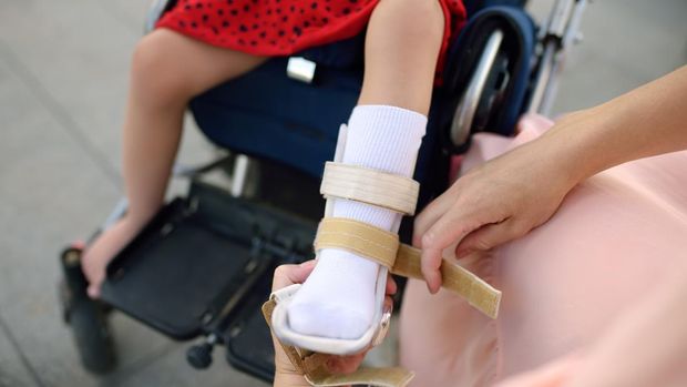 cerebral palsy