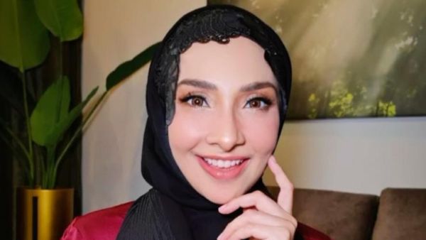Foto Artis Selamatkan Anak dari Penculikan, Wajah Cantiknya Kini Luka-luka