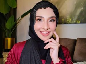 Foto Artis Selamatkan Anak dari Penculikan, Wajah Cantiknya Kini Luka-luka