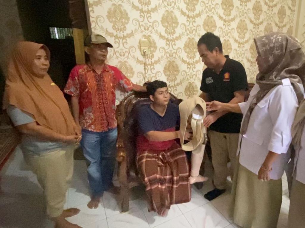 Andre Rosiade Bantu Kaki Palsu Pemuda Korban Kecelakaan di Pariaman Andre Rosiade Bantu Kaki Palsu Pemuda Korban Kecelakaan di Pariaman