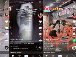 Kronologi Wanita Cimahi Kena Skoliosis 44 Derajat, Badan Kaku Seperti Robot