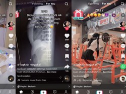 Viral Wanita Cimahi Kena Skoliosis 44 Derajat, Kini Sembuh-Bisa Ngegym