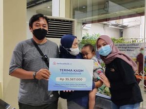 Kabar Bahagia Balita Rakha dengan Pipi Membesar, Kini Siap Operasi Plastik