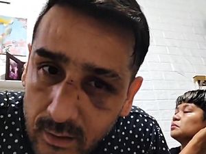 Wajah Lebam, Claudio Martines Buka Suara soal Pengeroyokan Pelayan Bar Wajah Lebam, Claudio Martines Buka Suara soal Pengeroyokan Pelayan Bar