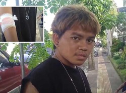 Kecelakaan Mobil Travel di Jembrana, Korban Dilarikan ke RS-Puskesmas