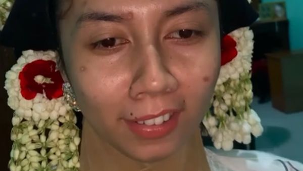 7 Foto Transformasi Makeup Pengantin Viral dengan Bekas Cacar