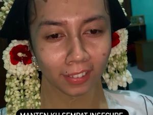 7 Foto Transformasi Makeup Pengantin Viral dengan Bekas Cacar