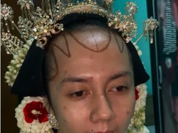 Viral Transformasi Makeup Pengantin dengan Bekas Cacar, Bikin Terkejut