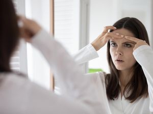 Penyebab dan Cara Tepat Mengatasi Jerawat