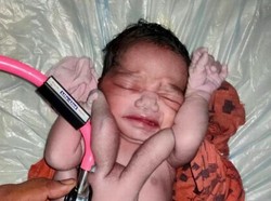 Bayi Dewa Punya Empat Tangan dan Kaki Lahir di India