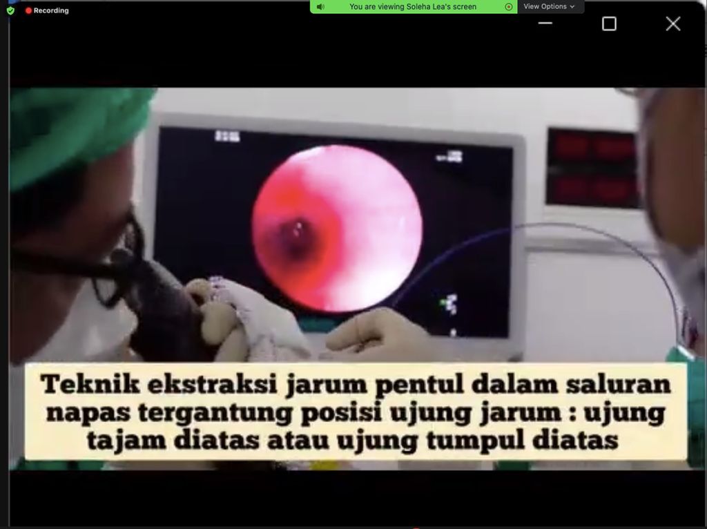 Batuk Bercak Darah, Gadis asal Depok Ini Ternyata Tersedak Jarum Pentul Batuk Bercak Darah, Gadis asal Depok Ini Ternyata Tersedak Jarum Pentul