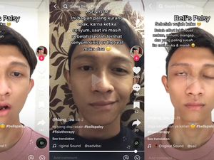 Fakta-fakta Pria Tangerang Kena Bells Palsy, Disebut Gegara Sering Kena AC Fakta-fakta Pria Tangerang Kena Bells Palsy, Disebut Gegara Sering Kena AC