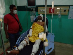 Pedagang Bakso di Deli Serdang Terbakar Usai Ganti Gas 3 Kg