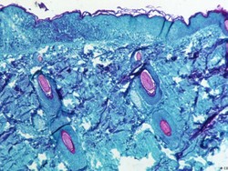 Peneliti: Virus Cacar Monyet Bermutasi dengan Cepat