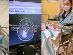 Viral Wanita 20 Tahun Asal Jakbar Idap Tumor Otak, Awalnya Mengeluh Sakit Kepala