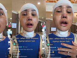 Lucinta Luna Jalani Operasi Tulang Ekor, Untuk Apa Sih?