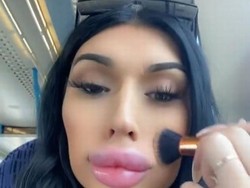 Transgender Ini Filler Bibir Setiap Patah Hati, Penampilannya Bikin Shock