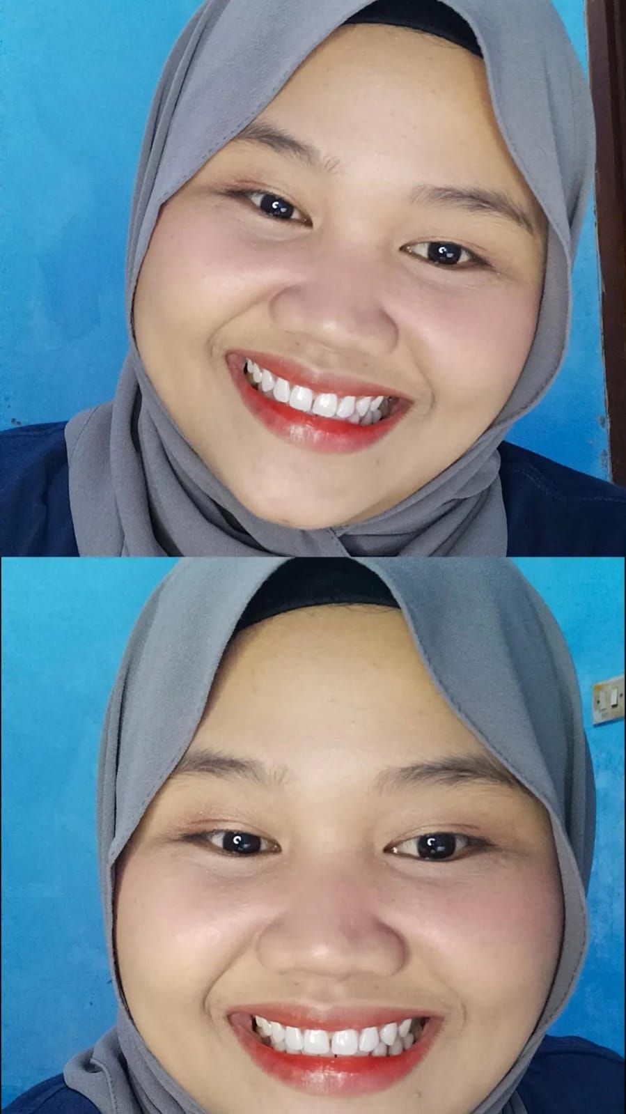 Treatment di Rata.id