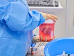 Ilmuwan Cangkok Jantung Babi ke Orang Meninggal, Buat Apa?