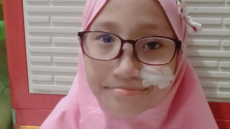 Donasi Sahabat Baik Bantu Haura Penderita Wolf Hirschhorn Beli Susu Khusus