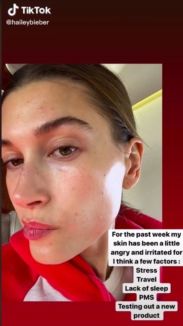 Hailey Bieber