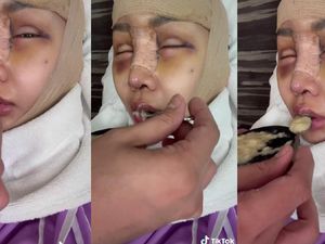 Kondisi Lucinta Luna Usai Gergaji Rahang, Operasi Khodam, hingga Tulang Ekor Kondisi Lucinta Luna Usai Gergaji Rahang, Operasi Khodam, hingga Tulang Ekor