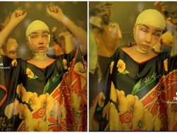 Lucinta Luna Kayang Pasca Operasi, Berakhir Jahitan Sobek