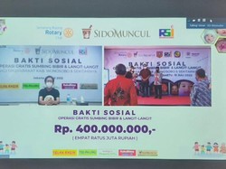 Sido Muncul Salurkan Rp 400 Juta untuk Operasi Bibir Sumbing Gratis