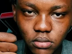 Seleb TikTok Ini Minta Doa Untuk Keselamatannya Usai Makan Laba-laba