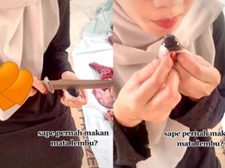 Kayak Makan Jelly, Wanita Ini Doyan Mengunyah Mata Sapi Mentah