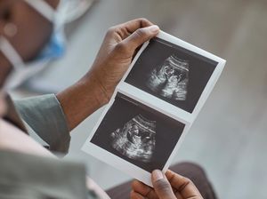 RUU Kesehatan Juga Singgung Aborsi, Poin Ini Jadi Sorotan Dokter Kandungan