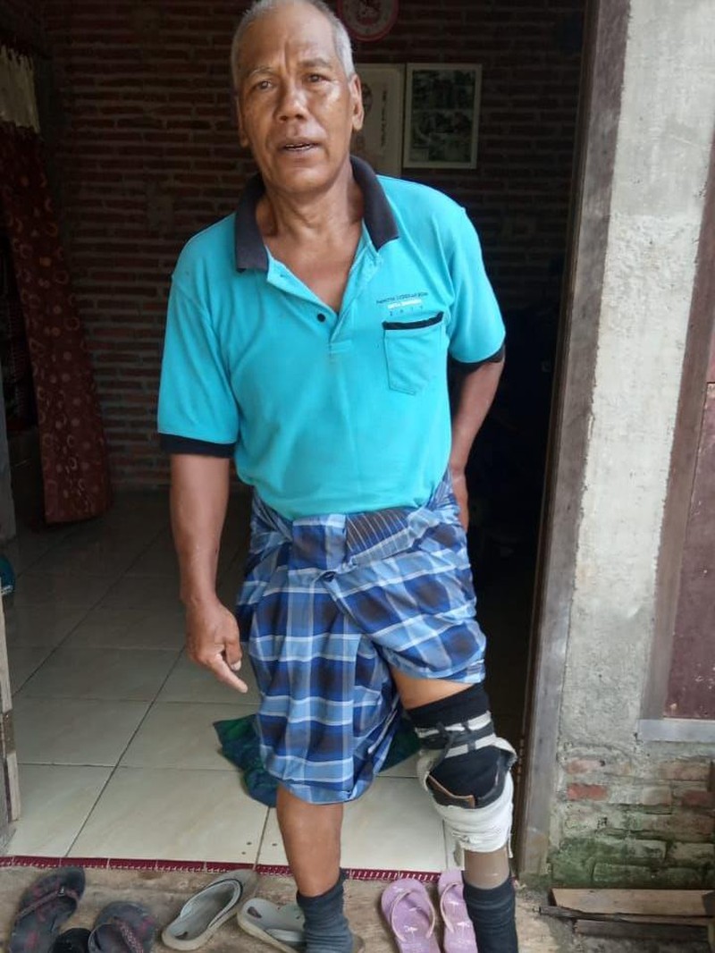 Kisah Sedih Pak Sarlan Butuh Kaki Palsu Baru, Kamu Bisa Bantu