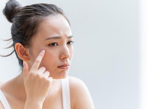 Skin Barrier Rusak? Ini Ciri-ciri dan Cara Mengatasinya